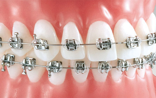 Brackets