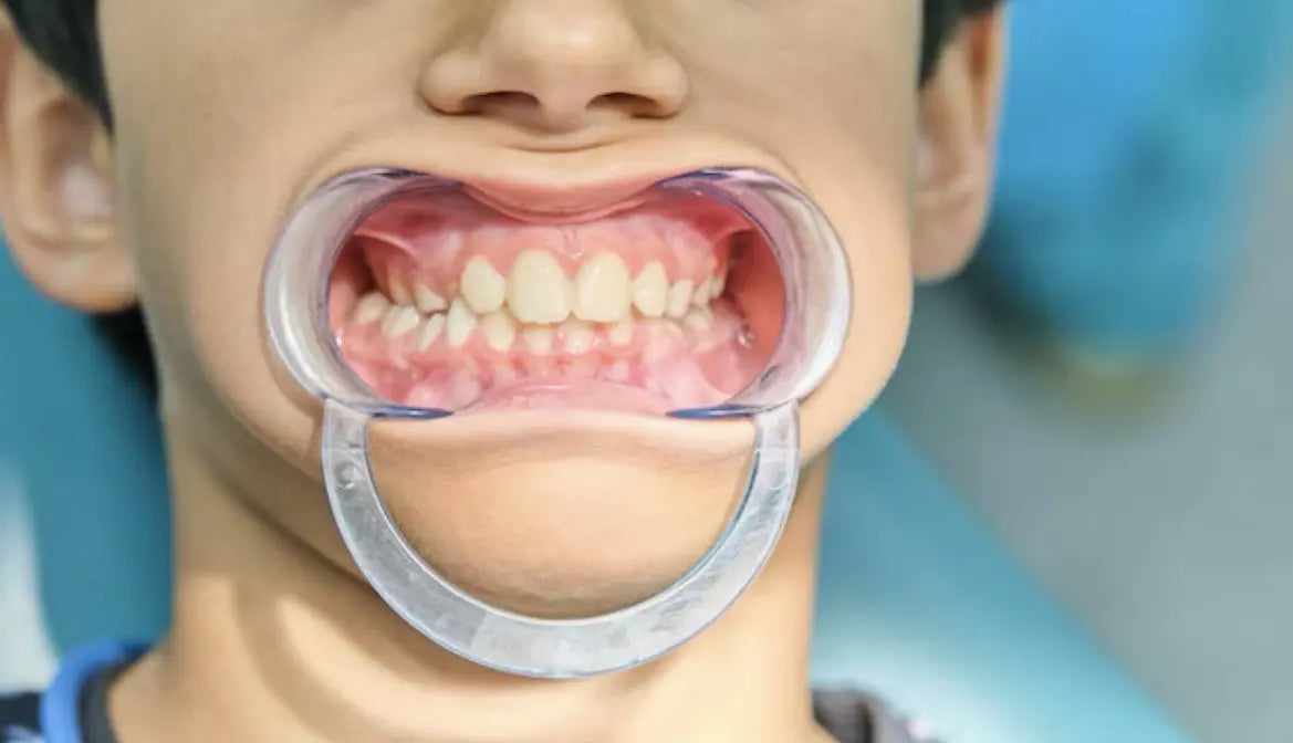 Tienda DDC - Anelsam - CLINICA - Retractor Dental En Froma De C Circular De Labios Carillos | TiendaDDC.com