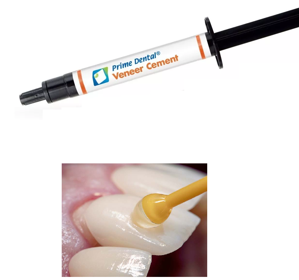Cemento Carillas Veneer Cement Prime Dent