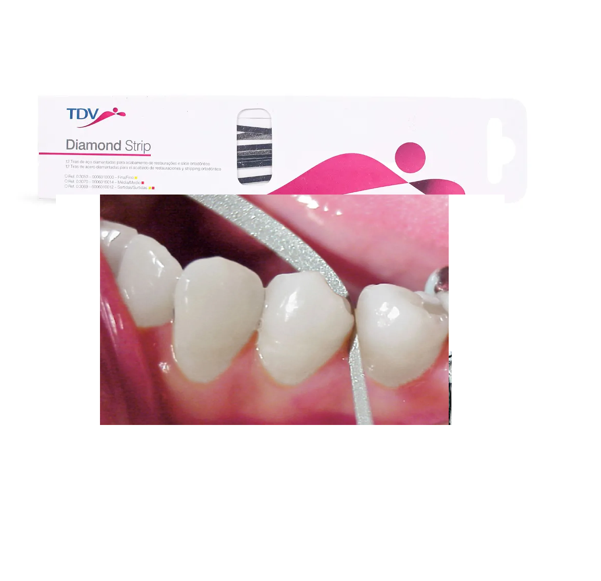 Tiras Stripping Dental tdv Diamond Strip ortodontic