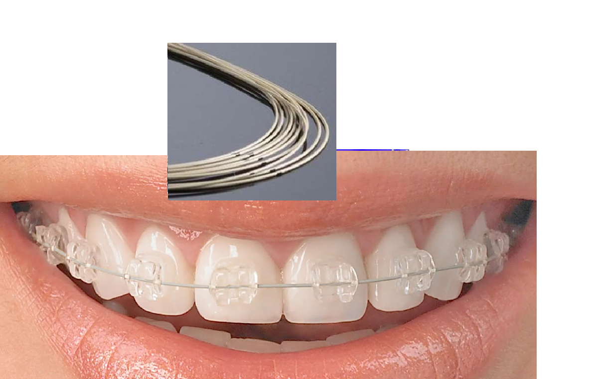 Arco NITI Estetico stylus 1arco