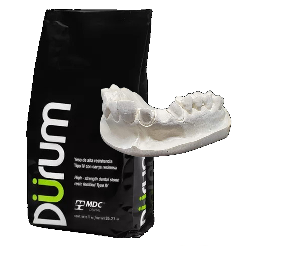 Mdc Durum dental 1 Kg Yeso Tipo 4 resinoso alta resitencia