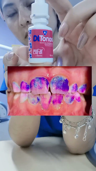 Ditonos Bote Revelador De Placa Bacteriana Dental