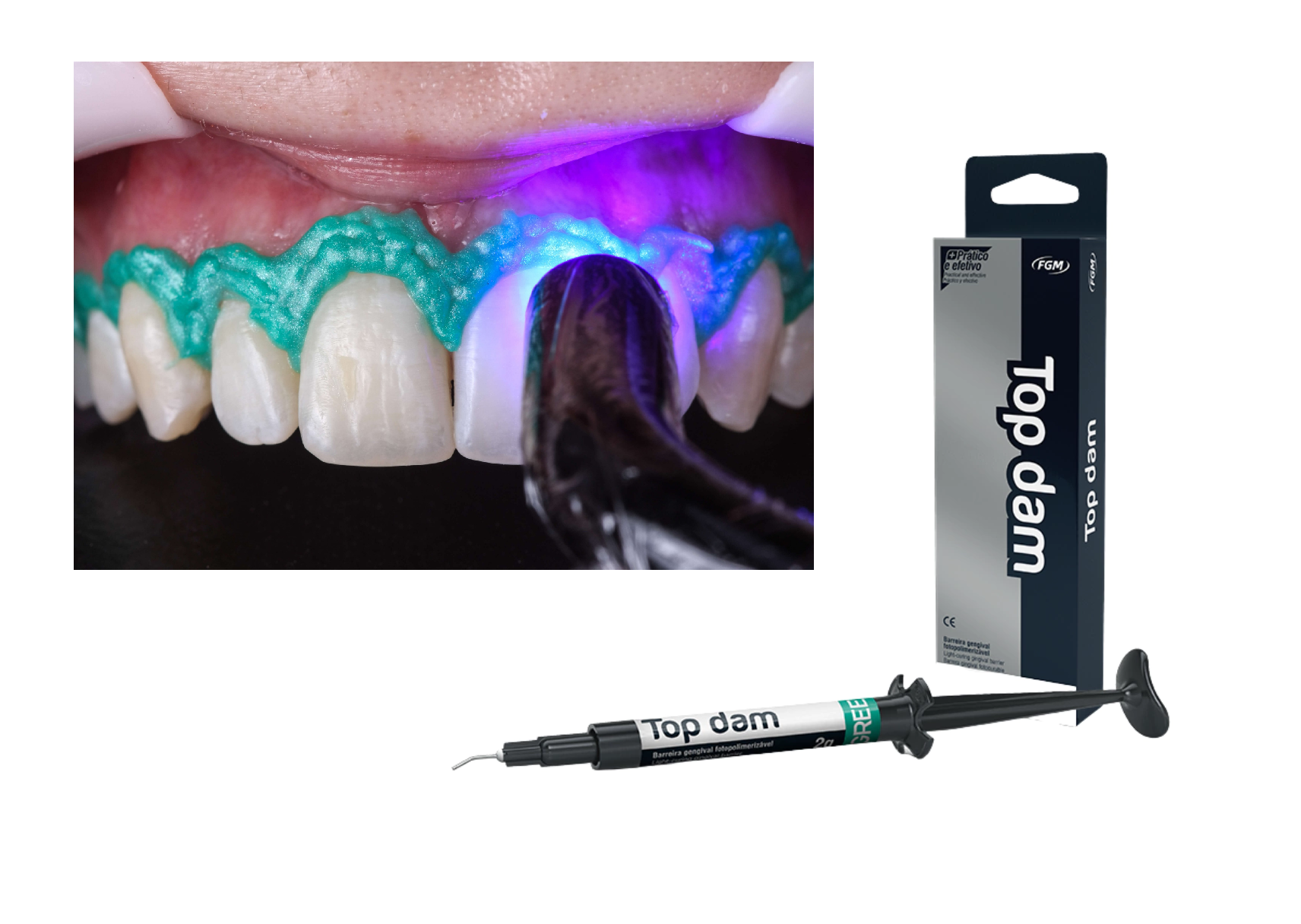 Tienda DDC - Deposito Dental Cadereyta - Barrera Gingival Top Dam Fgm | TiendaDDC.com