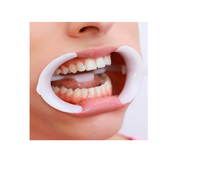 7598032320905 - FGM - CLINICA - Retractor Labios y lengua Dental Arcflex Esterilizable | TiendaDDC.com