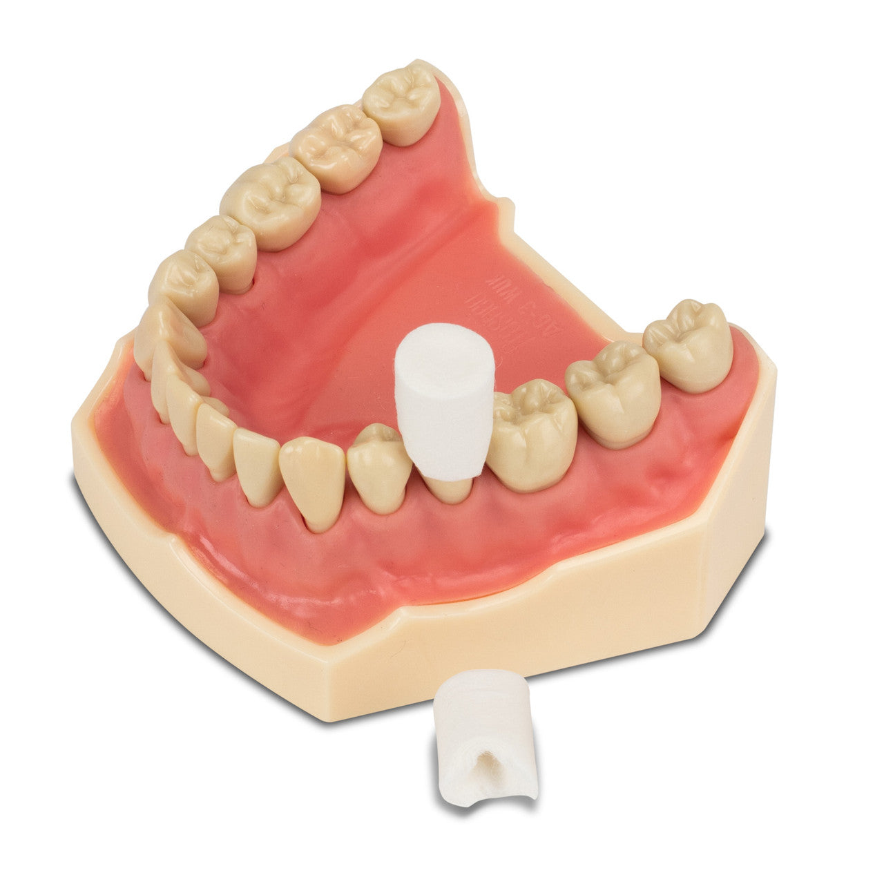 7777777777 - Podcutos de Mayor costo - Retraction Caps - retraccion gingival dental 60pz | TiendaDDC.com