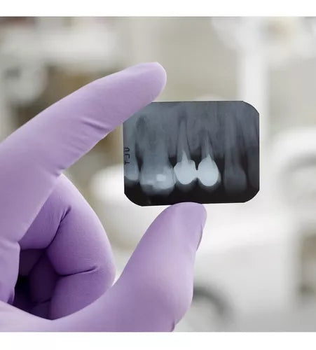 RADIOGRAFIA CARESTREAM E-SPEED PELICULA INTRAORAL  #2 AZUL