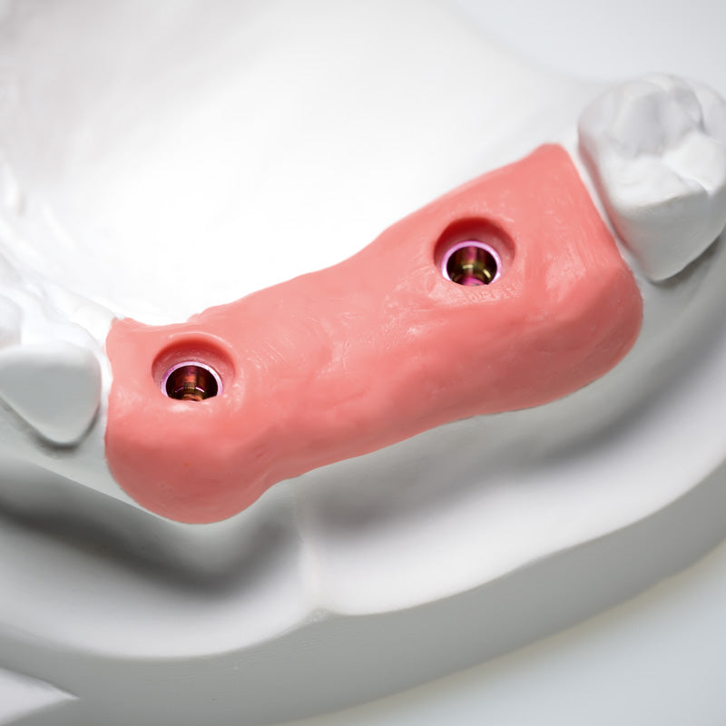 Gingifast