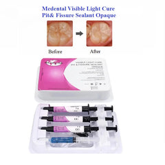 Sellador de Fosetas y Fisuras Fotocurable Medental 3 jer y 1 acido