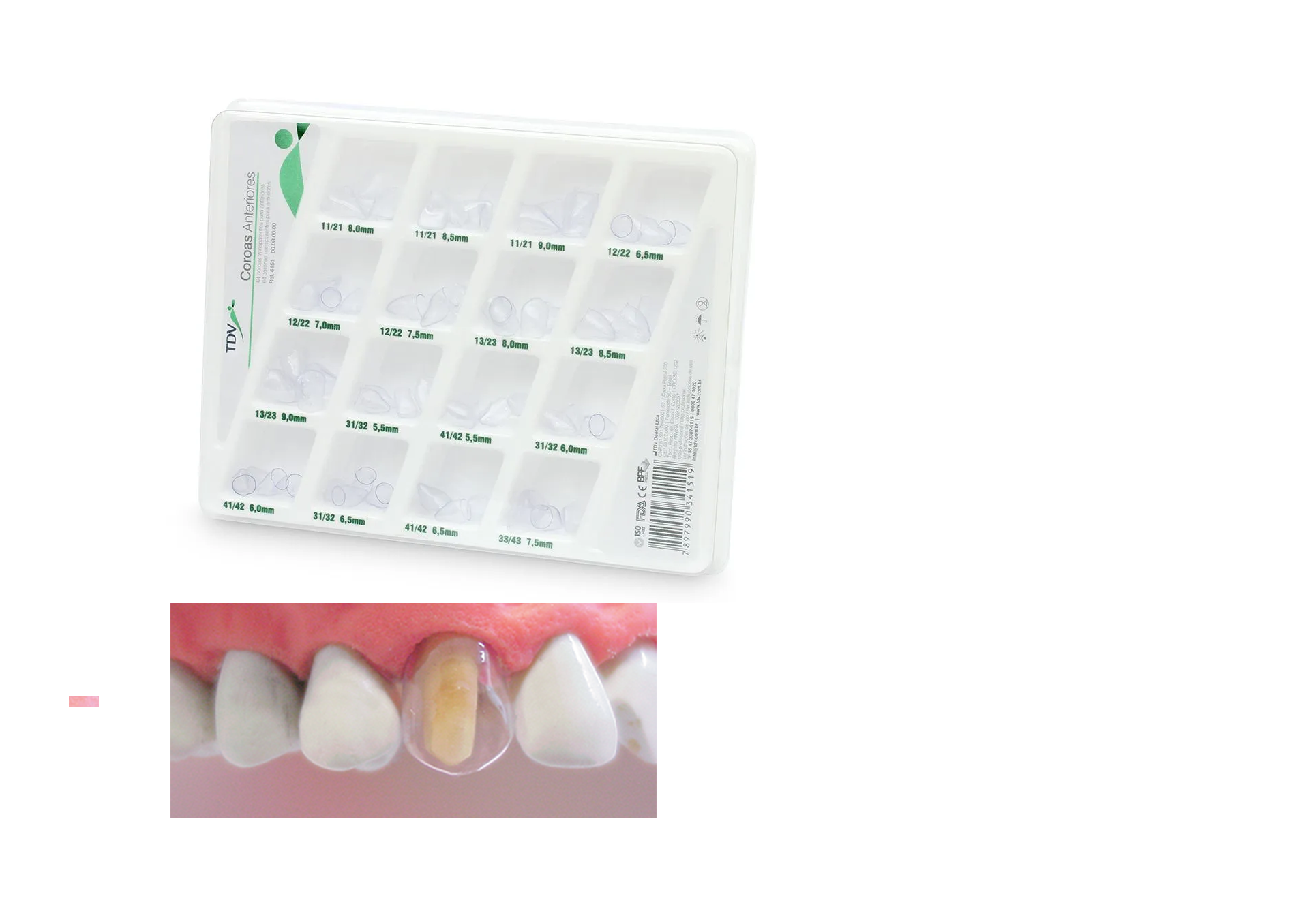 Coronas Dentales Transparentes preformadas Tdv