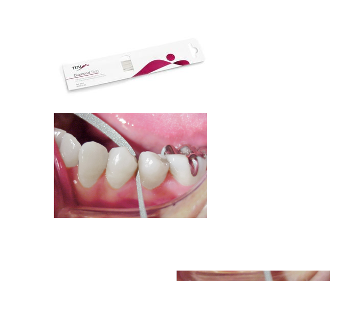 Tienda DDC - TDV - ORTO - Tira Lija Acero Diamantada Fino 2.5mm Tdv Stripping Dental 12pz | TiendaDDC.com
