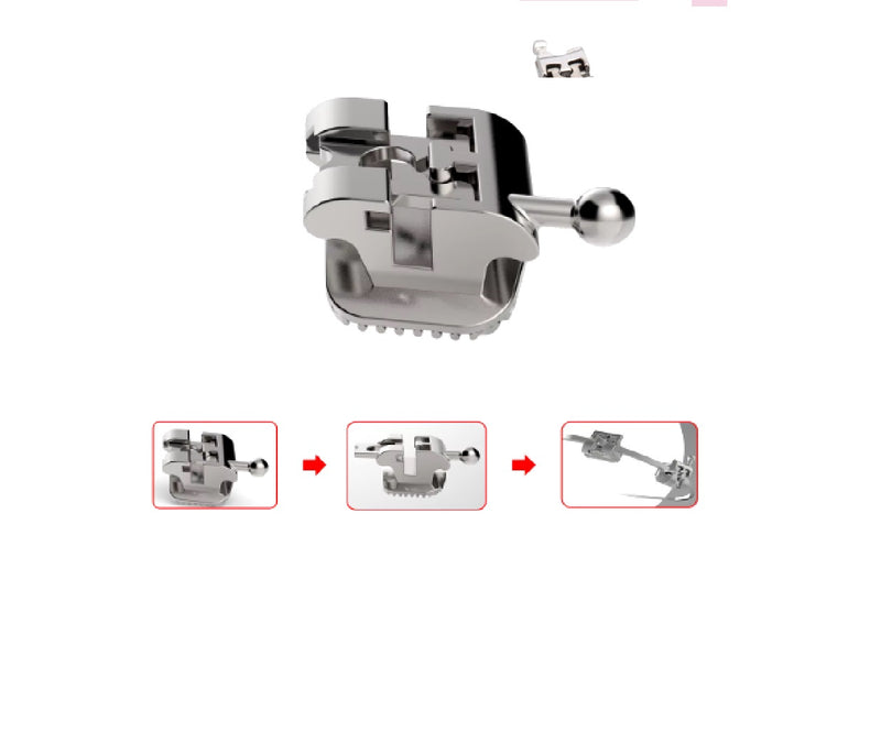 Bracket Autoligado + Tubos Incluye Pinzas Azdent