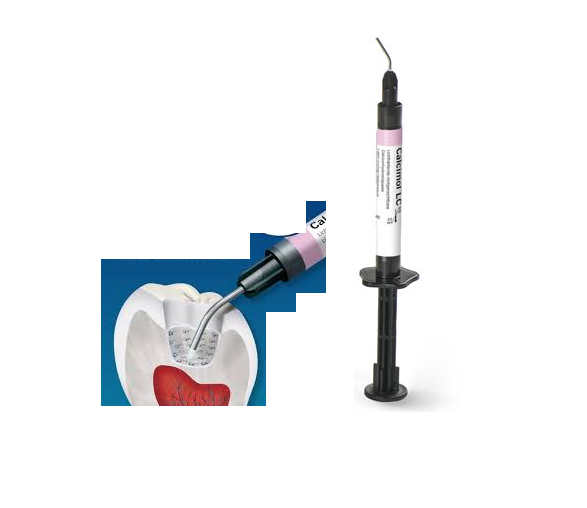 Tienda DDC - VOCO - CLINICA - Calcimol LC | TiendaDDC.com