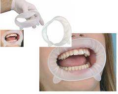 Optragate Separador Para Labios Y Mejillas Ivoclar 1pz