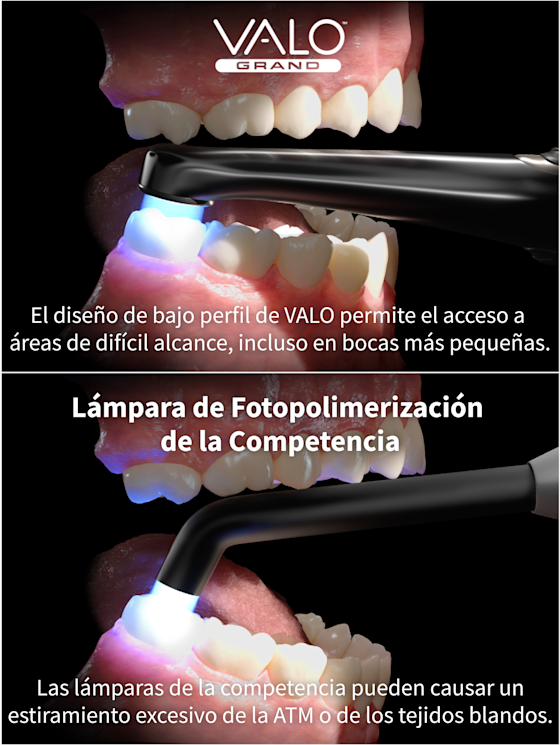Lampara Valo GRAND Ultradent Denta Fotocura En 1 Segundo
