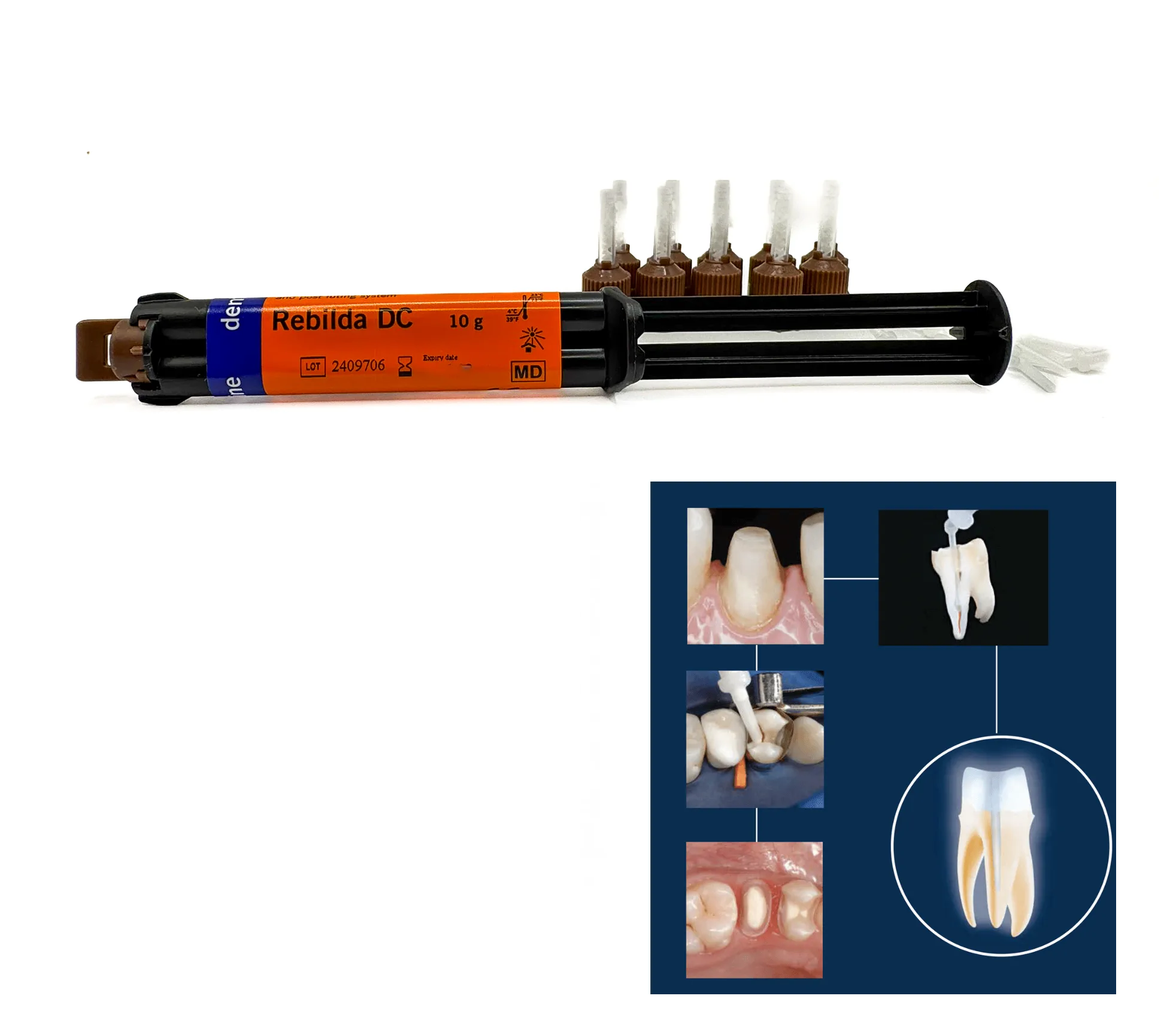 Tienda DDC - VOCO - RESTA - Rebilda Qm Dc 10g Voco + preformadores muñones | TiendaDDC.com