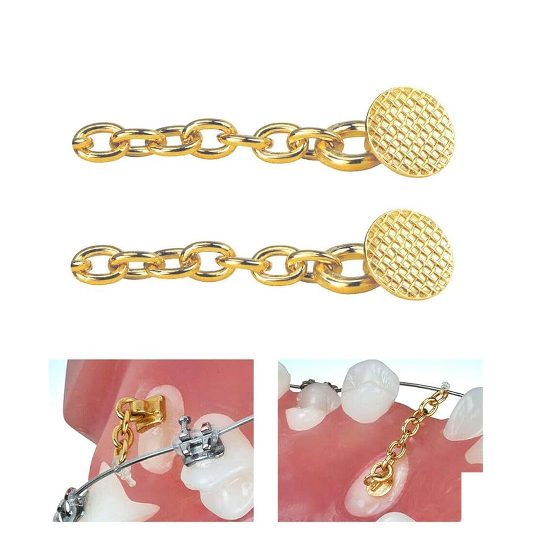 Tienda DDC - AZDENT - ORTO - Cadena de tracción ortodoncaia AZDENT con botones y cadena dorado | TiendaDDC.com